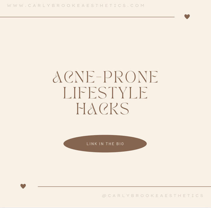 Acne Prone Lifestyle Hacks